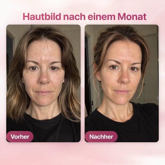 Kollagen Maske